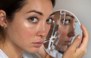 How to Repair a Damaged Skin Barrier (Step-by-Step Guide)