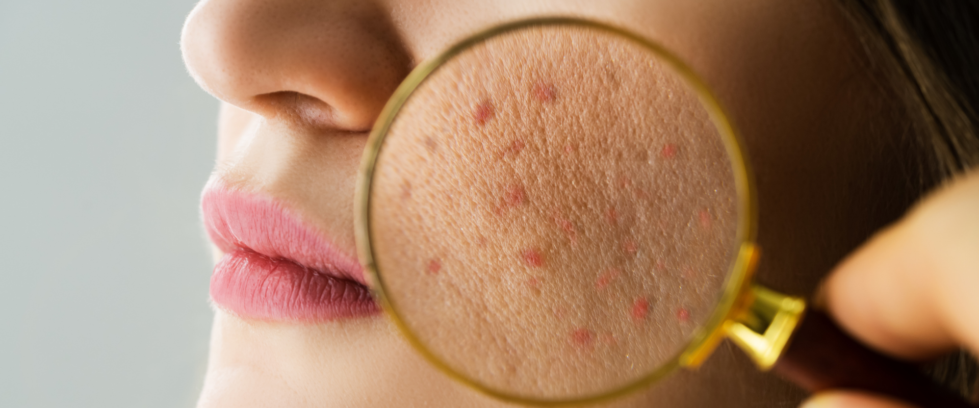 Understand the damage