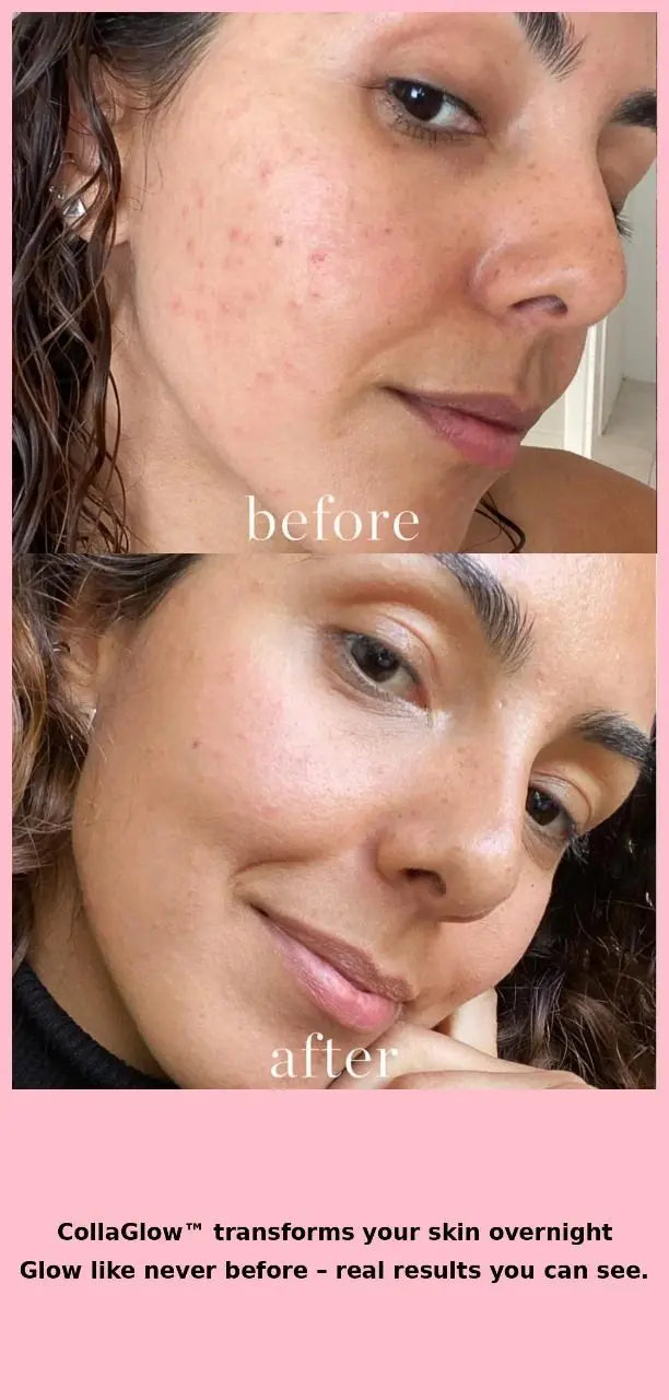 Awaken to Radiant, Youthful Skin Overnight