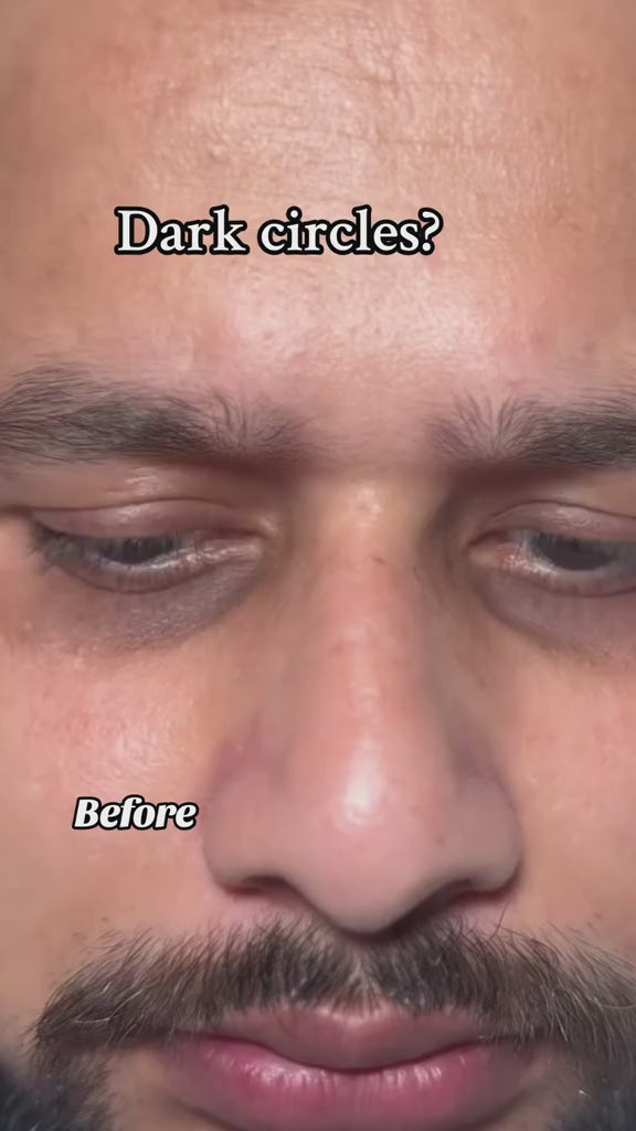 SEOUL 1988 Eye Cream: Retinal Liposome 4% + Fermented Bean video