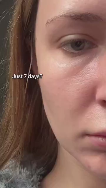 SEOUL 1988 Eye Cream: Retinal Liposome 4% + Fermented Bean video